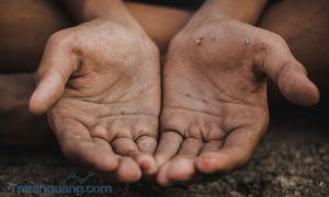 Dunia Dalam Ancaman Kelaparan dan Krisis Pangan Setelah Pandemi Corona